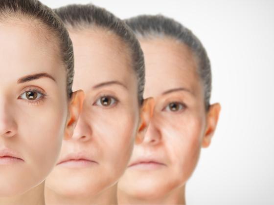 anti-aging-treatment-Sanjeeva Reddy Nagar-hyderabad